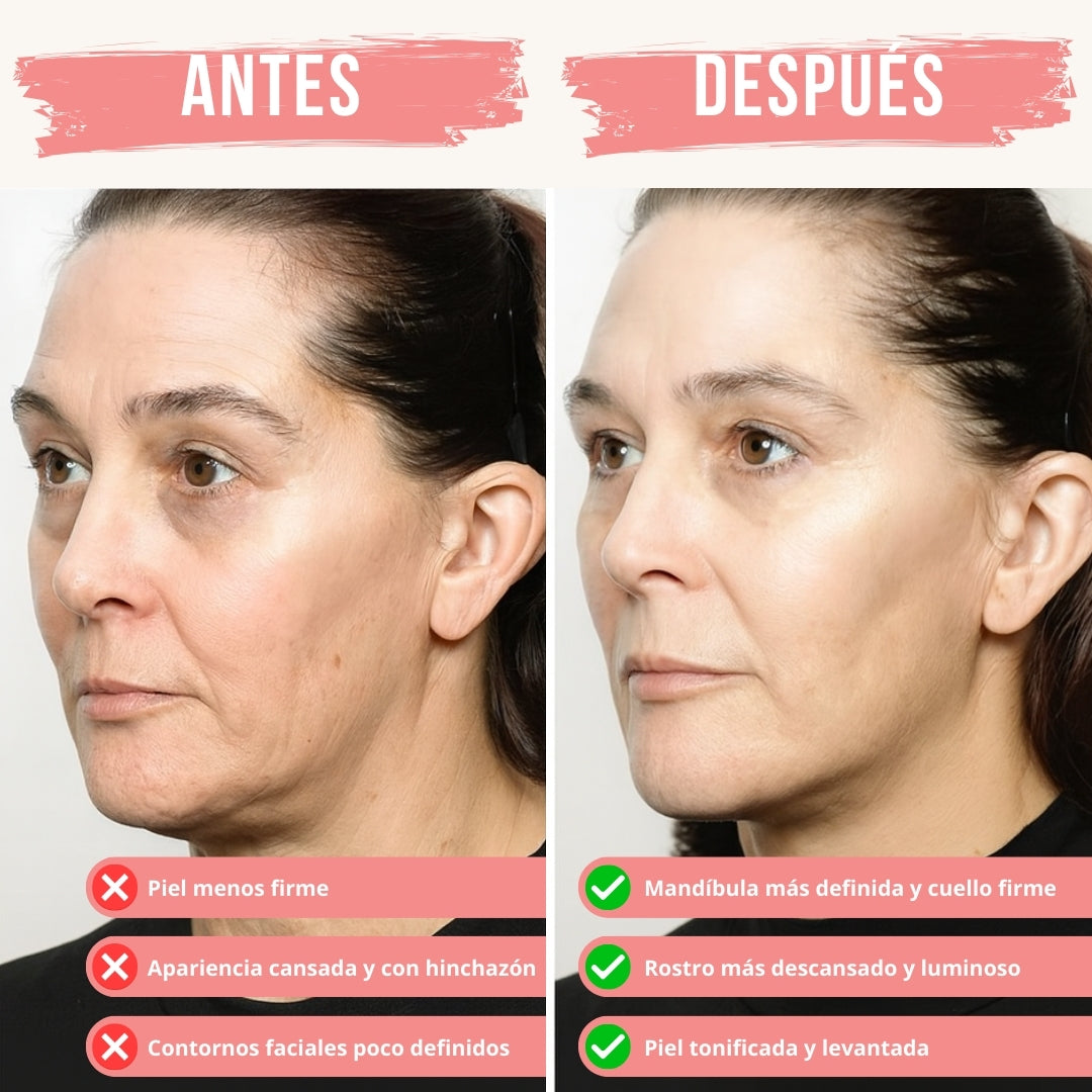 Refleja® GlowLift - Masajeador Facial de Microcorriente