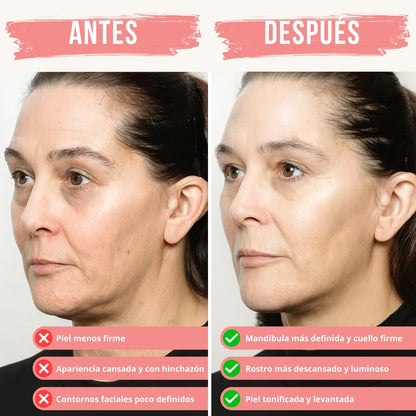 Refleja® GlowLift - Masajeador Facial de Microcorriente